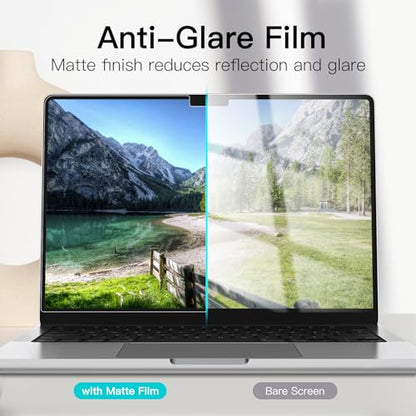 JETech 14.2 Inch 1601- Matte PET Anti-Glare Screen Protector